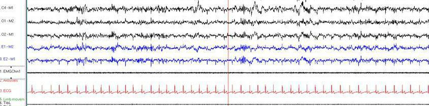 Kviečiame į konferencija  „Epilepsija – tai žinoti&nbsp;būtina“
