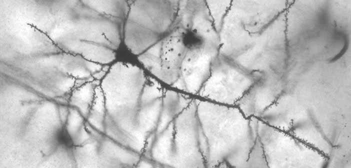 Sergate epilepsija – tai&nbsp;kas!